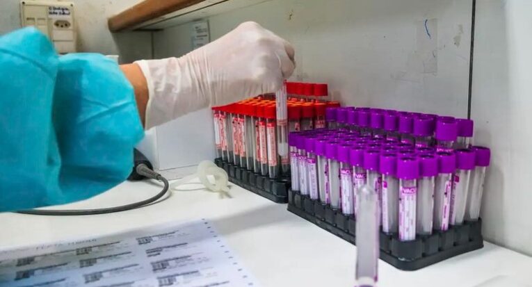 A adoção das cores roxo e laranja para cada campanha está relacionada a características específicas de cada doença (Arquivo/Agência Brasil)