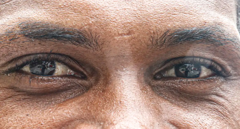 Além da cor dos olhos, outras características particulares fazem da íris um dado biométrico, que permite a identificação pessoal (Paulo Pinto/Agência Brasil)  